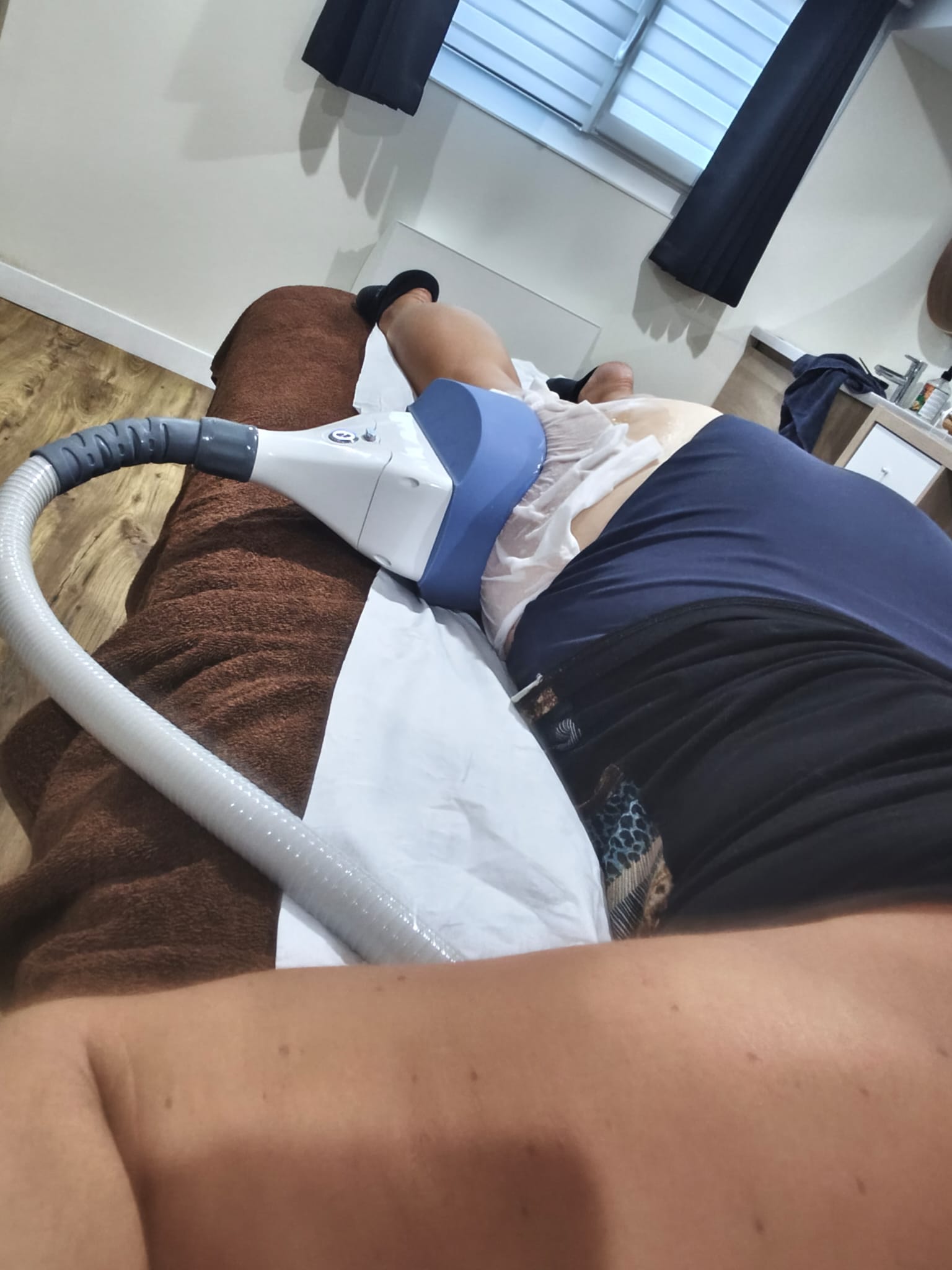 Séance de Cryolipolyse en action dans la cabine privée d'Escapade Beauté à Brethenay